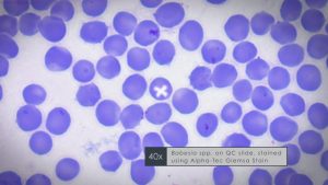 Microscopic Slides of Babesia bovis and Babesia bigemina - Prof. U. K